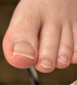 Pedicure behandeling sfeerbeeld